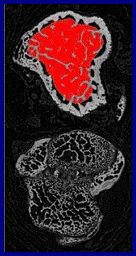 MICRO-CT